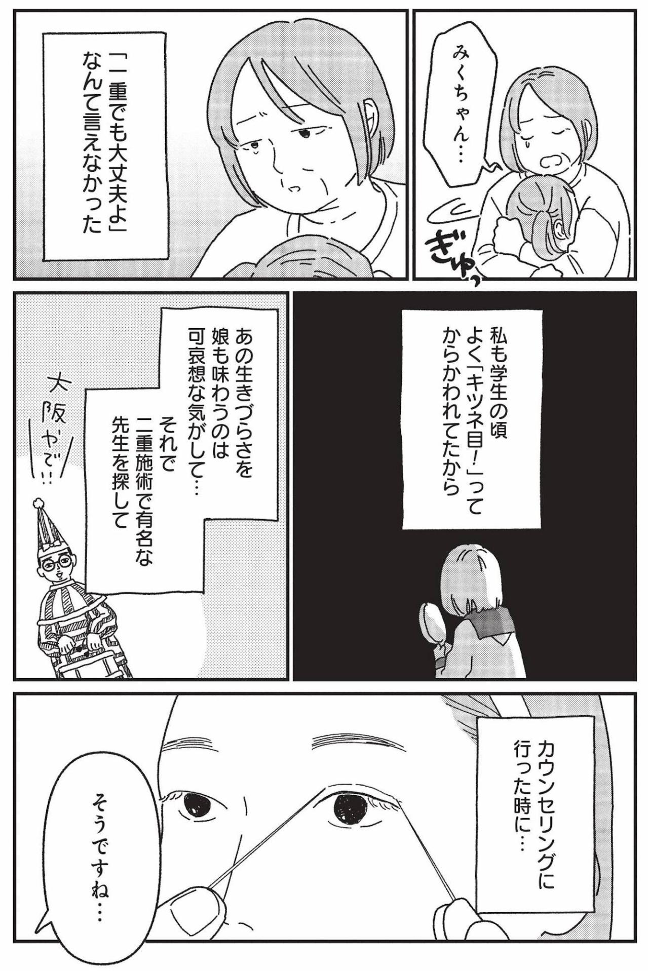 今のままでもかわいい、それでも整形したい娘…母娘が選ぶ答えは？【女の人生に整形って必要ですか？ #22】（画像4）