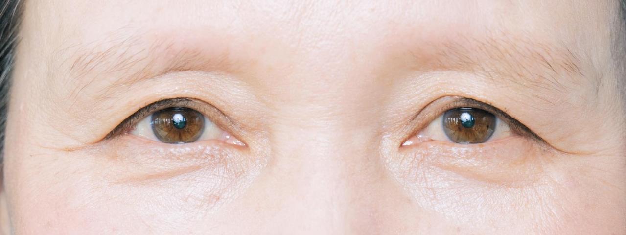 薄眉で眉が決まらない62歳が体験！ 医療アートメイクで「似合う眉」を手にいれるまで（画像11）