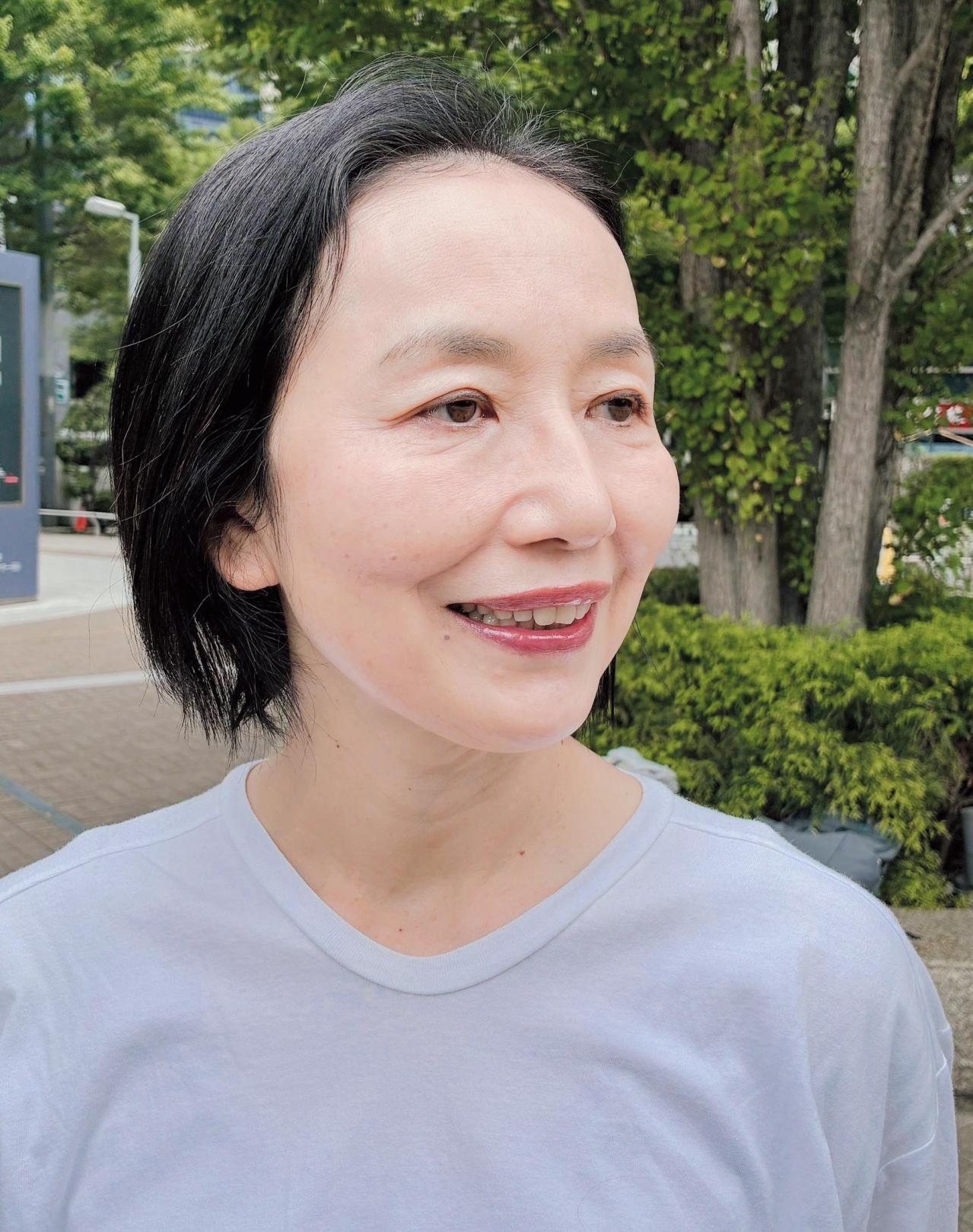 シミ取り光治療（IPL）ってどんな施術？レーザーとの違い・回数・注意点がわかるQ＆A（画像5）
