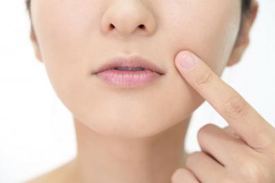 本気の【シミ】対策に！５0代から始める美容医療の基礎知識。【シミ編】