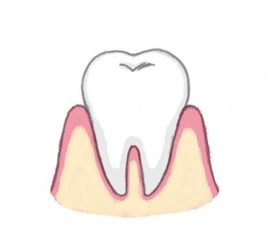 「ハグキが下がってきた」の悩みは加齢のせい？ あまり知られていない真実とは？（サムネイル画像3）