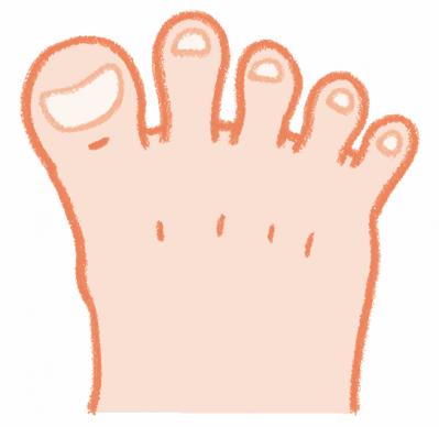 健康寿命を延ばす【歩行速度】とは？ 足の専門医がアドバイス（サムネイル画像6）