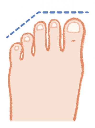 ヒールの高さは何センチがよい？足の健康寿命を延ばす【靴の選び方】専門医がアドバイス（サムネイル画像6）