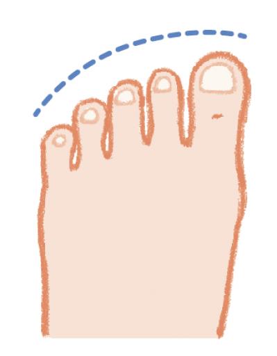 ヒールの高さは何センチがよい？足の健康寿命を延ばす【靴の選び方】専門医がアドバイス（サムネイル画像4）