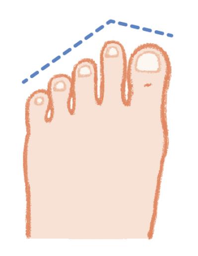 ヒールの高さは何センチがよい？足の健康寿命を延ばす【靴の選び方】専門医がアドバイス（サムネイル画像5）