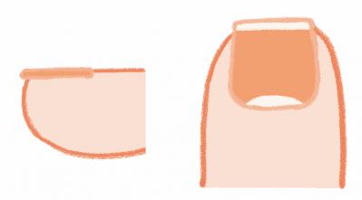 健康寿命を延ばす【歩行速度】とは？ 足の専門医がアドバイス（サムネイル画像7）