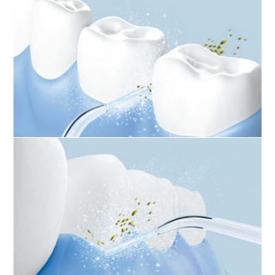 50代を過ぎたら要注意！「歯ブラシの磨き残し」を解消するオーラルケア【2選】（サムネイル画像6）