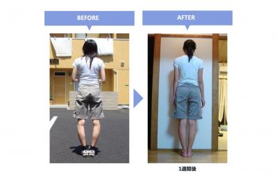 「妻のO脚を治したい！」理学療法士が開発した【5本指ソックス】その実力を編集部がレポート！（サムネイル画像3）