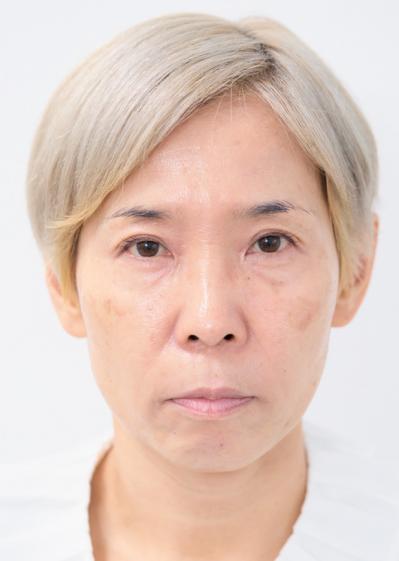 58歳 ヘアメイク職人・化け子が自らの顔で検証「シミに悩んでるならこの方法やってみて！」（サムネイル画像3）