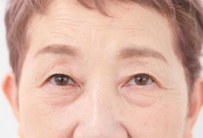 70代の【まぶたのたるみ】を補正する100均アイテムも！ ヘアメイク職人【化け子さん】おすすめ（サムネイル画像5）