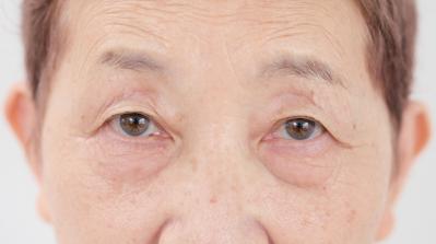 70代の【まぶたのたるみ】を補正する100均アイテムも！ ヘアメイク職人【化け子さん】おすすめ（サムネイル画像4）