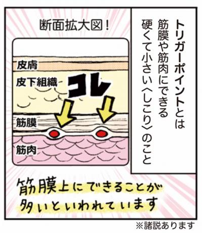 超ほぐれる「トリガーポイント」って一体何？肩こり・息苦しさのお悩みに【マンガでセルフケア】（サムネイル画像3）