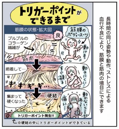 超ほぐれる「トリガーポイント」って一体何？肩こり・息苦しさのお悩みに【マンガでセルフケア】（サムネイル画像8）