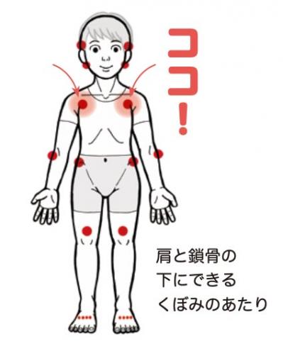 「肩こり・息苦しさ」を解消「トリガーほぐし」のやり方とは？【マンガでセルフケア】（サムネイル画像2）