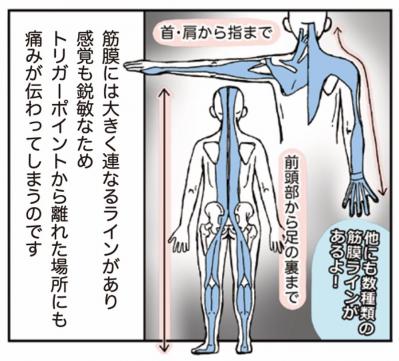 超ほぐれる「トリガーポイント」って一体何？肩こり・息苦しさのお悩みに【マンガでセルフケア】（サムネイル画像6）