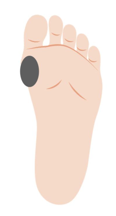 「その足放置していたらマズイかも…」足トラブルの危険度をチェック！セルフケア方法も（サムネイル画像5）