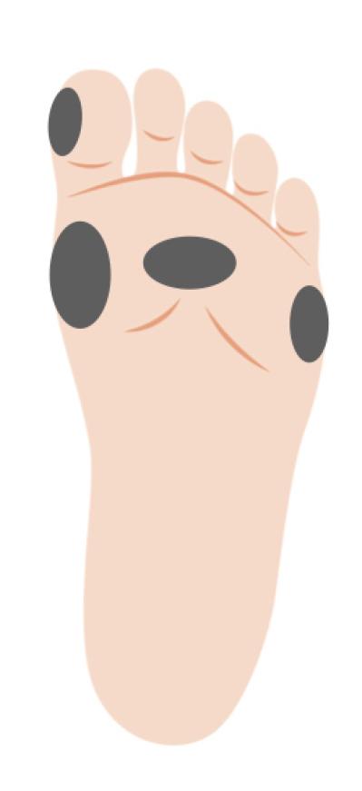 「その足放置していたらマズイかも…」足トラブルの危険度をチェック！セルフケア方法も（サムネイル画像9）