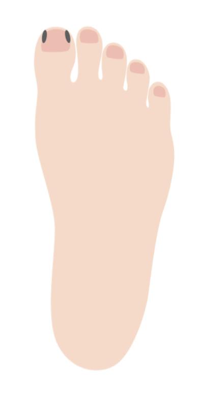 「その足放置していたらマズイかも…」足トラブルの危険度をチェック！セルフケア方法も（サムネイル画像8）