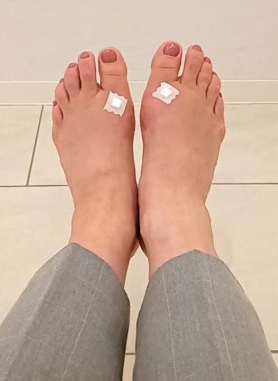 【外反母趾】痛みが消えるのは悪化のサイン!? 放置すると激痛を引き起こす【強剛母趾】も要チェック（サムネイル画像7）