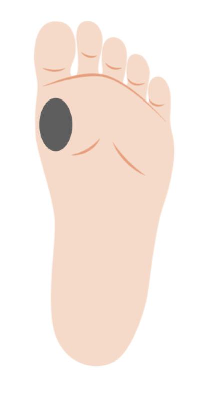 「その足放置していたらマズイかも…」足トラブルの危険度をチェック！セルフケア方法も（サムネイル画像6）