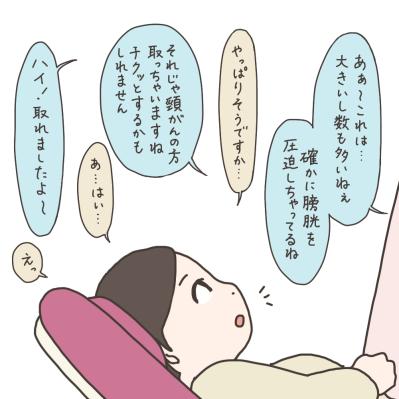「どうしても子宮ごと取らないとダメですか？」大学病院の先生に尋ねた【実録！40代婦人科トラブル＃10】（サムネイル画像6）
