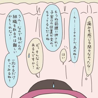 「どうしても子宮ごと取らないとダメですか？」大学病院の先生に尋ねた【実録！40代婦人科トラブル＃10】（サムネイル画像7）