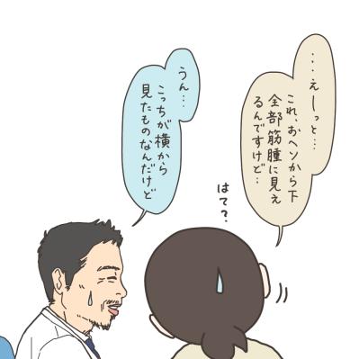 MRI撮影…子宮筋腫の大きさは？【実録！40代婦人科トラブル＃14】（サムネイル画像15）