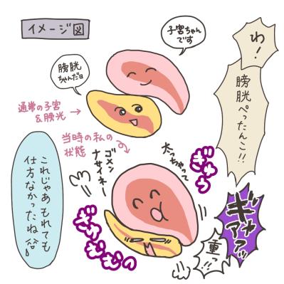 MRI撮影…子宮筋腫の大きさは？【実録！40代婦人科トラブル＃14】（サムネイル画像16）