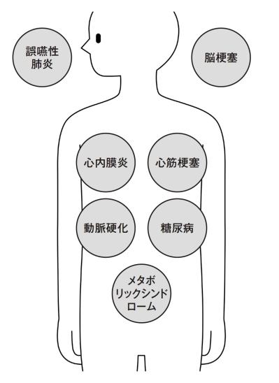 「60代以上は放置すると危険！」糖尿病や認知症にもなりうる【歯周病菌】今すぐできる予防法は？（サムネイル画像4）