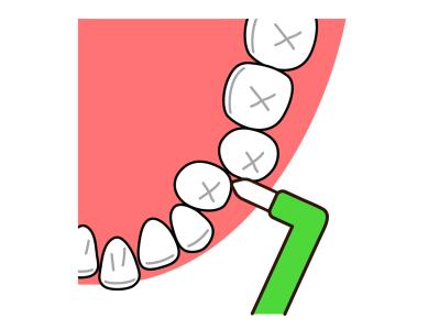シニア専門の歯科医がすすめる【正しい歯の磨き方】歯ブラシ時間は何分？歯間ブラシは毎回やるべき？徹底解説（サムネイル画像6）