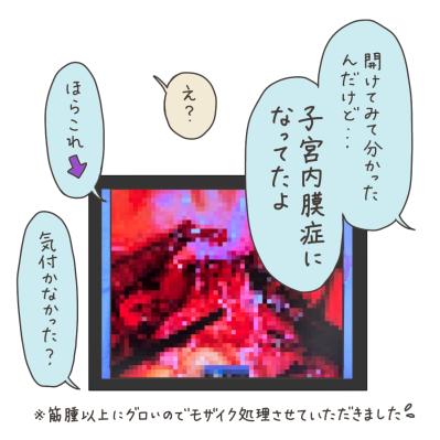 薬で筋腫は小さくなっていなかった！薬が効いていたように思えた理由は？【実録！40代婦人科トラブル＃46】（サムネイル画像14）