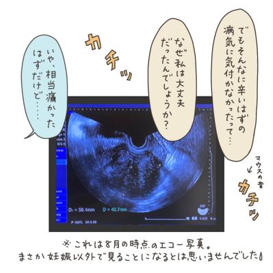 「もしかしてニブい？」子宮筋腫のほかに判明したのは…【実録！40代婦人科トラブル＃47】（サムネイル画像4）
