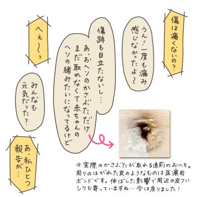 【最終回】子宮全摘手術から1年半…悩みに悩んで全摘した感想は？【実録！40代婦人科トラブル＃51】（サムネイル画像5）