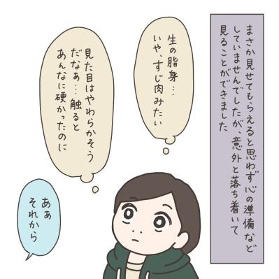 薬で筋腫は小さくなっていなかった！薬が効いていたように思えた理由は？【実録！40代婦人科トラブル＃46】（サムネイル画像13）