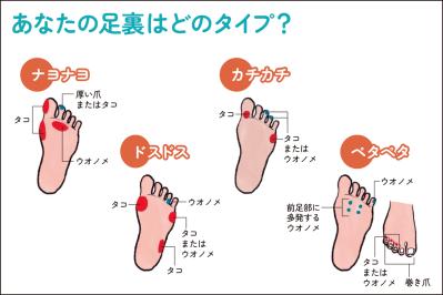【足連載／第２歩】タコ1つでも要注意!? 知らないと損する足裏からわかる４つのタイプ別対策法（サムネイル画像2）