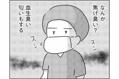 ドラマの手術室とは違った――焦げた匂いとチェーンソーの音【手術室の中で働いています。 #8】