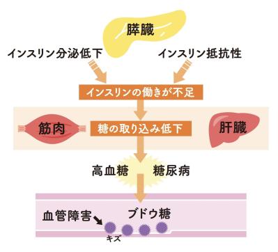 【要注意】成人の5～6人に1人が糖尿病かその予備群！「ヘモグロビンA1c」の数値でわかることとは？（サムネイル画像4）