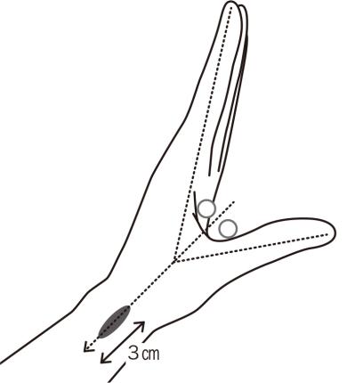 力を入れると、指がカクンと跳ね上がる！【ばね指】に効く「10秒神経マッサージ」とは？［医師が解説］（サムネイル画像4）
