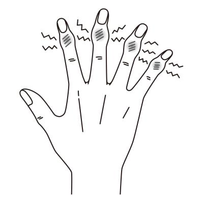 中高年女性の「指に力が入らない」「ふたが開けられない」へバーデン結節にも！【10秒神経マッサージ】とは？（サムネイル画像2）