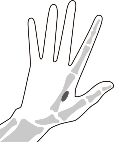 中高年女性の「指に力が入らない」「ふたが開けられない」へバーデン結節にも！【10秒神経マッサージ】とは？（サムネイル画像4）