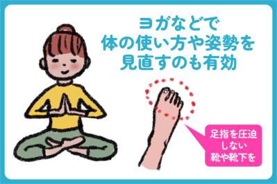 いつ病院に行くべき？足の不調で知っておきたいサインとケア方法【足連載／第６歩・後編】（サムネイル画像3）