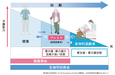 「え、ペットボトルが開かない⁉︎」それ、年のせいじゃないかも【フレイルの初期症状】今すぐセルフチェック！（サムネイル画像2）