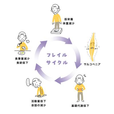 「外出がおっくう」は危険サイン⁉ 【フレイル】の入り口を左右する2つのポイントとは？（サムネイル画像4）