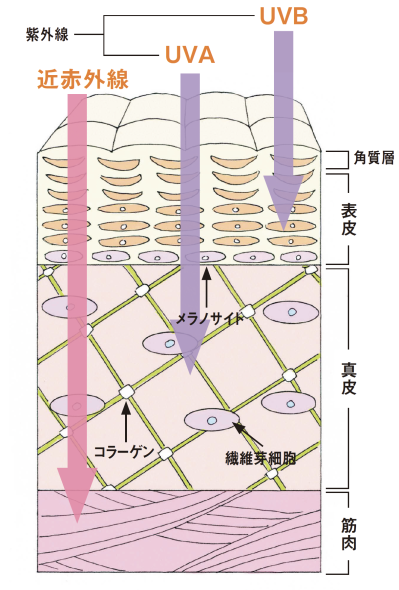 紫外線より実は強力！【近赤外線】がシワやたるみの原因かも!? 対策法を医師が解説（サムネイル画像5）