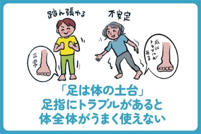 小指の爪が小さい人は要注意？夏前に始めたい巻き爪・足トラブル対策【足連載／第９歩】（サムネイル画像4）