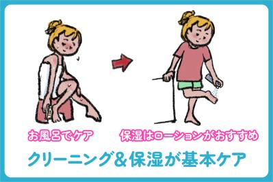 巻き爪・ウオノメ・かかとのひび割れ……足トラブル別セルフケア術【足連載／第10歩・後編】（サムネイル画像3）