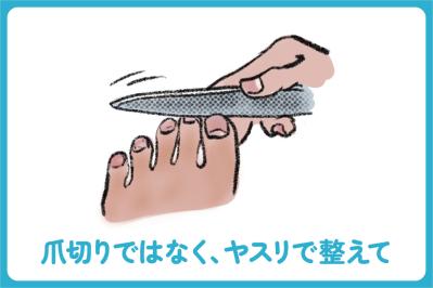 タイプ別で知りたい！足と爪を守る毎日のケアと履き物選び【足連載／第10歩・前編】（サムネイル画像2）