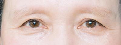 薄眉で眉が決まらない62歳が体験！ 医療アートメイクで「似合う眉」を手にいれるまで（サムネイル画像11）