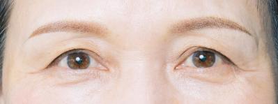 薄眉で眉が決まらない62歳が体験！ 医療アートメイクで「似合う眉」を手にいれるまで（サムネイル画像13）