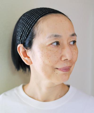 56歳読者モデルが体験！シミ・くすみに効く光治療（IPL）当日の流れと痛み、2日目の変化まで（サムネイル画像15）